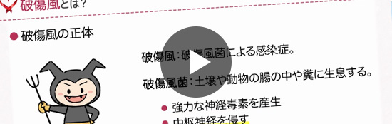 破傷風