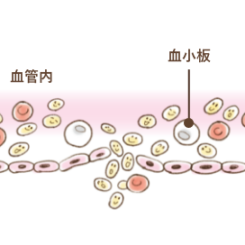 血が止まる仕組み:出血