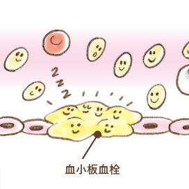 血が止まる仕組み:血小板血栓ができ一次止血